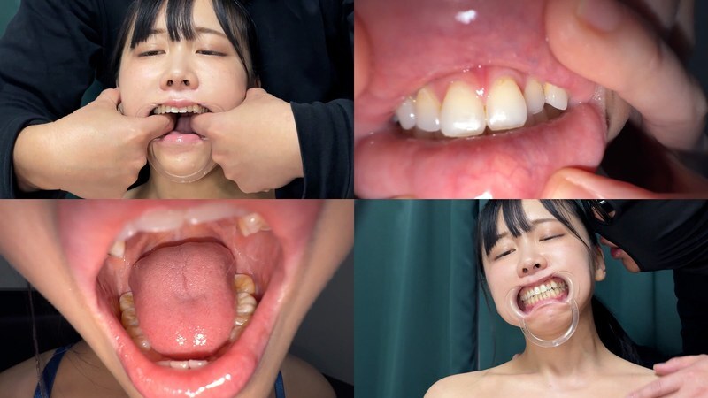 NKO-700001 Observing the inside of Suzu-chan's mouth as she drools profusely.